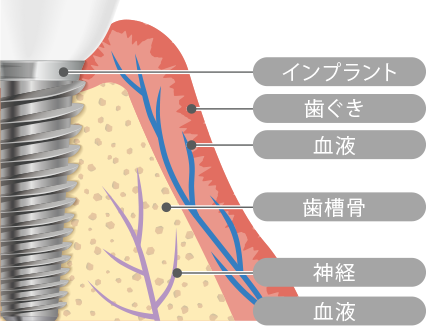 歯周組織を血液・栄養・細胞レベルから向上させるインナーヘルスケア