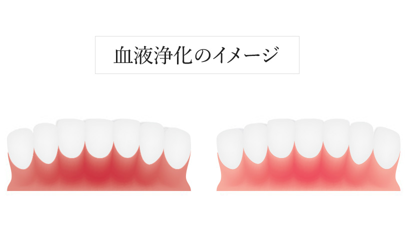 歯肉オゾン血液療法