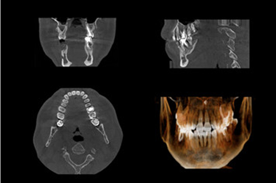 デジタル化で整合性を高める 読影の診断力