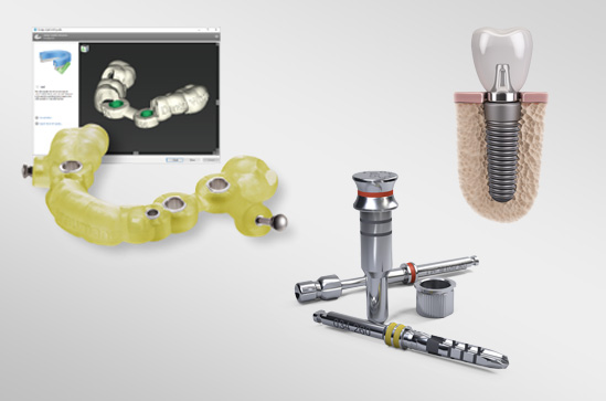 正確なポジショニングを決める 精密外科技術