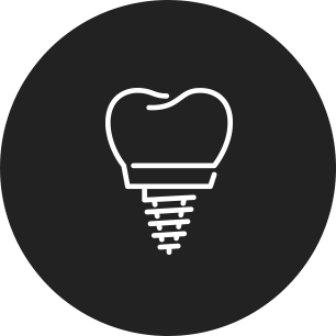 「オープントレー法」